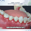 在南京牙周炎需要治疗多久 ——南京牙周炎治疗，推荐你到南京德牙联合口腔医院
