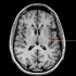 1.颅脑MRI解剖图谱-间脑MRI解剖