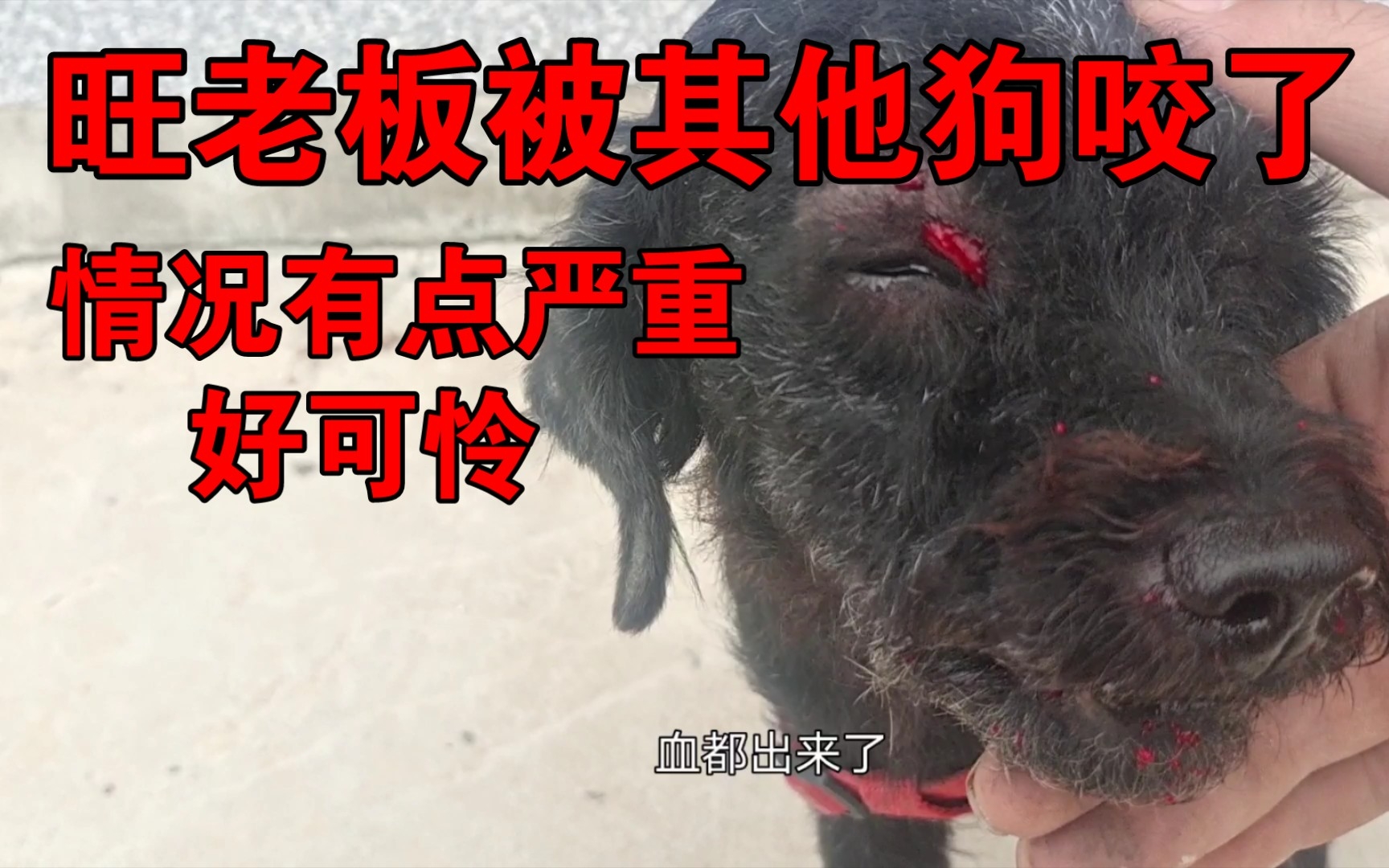 【突发】“疯狗”当街游荡，7岁儿童被咬伤！ - 徐州市矿山医院