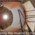 3D视频演示：矫正斜视眼手术