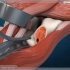 髋关节置换手术过程，3D演示。。