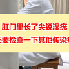 如果检查出肛门里长了尖锐湿疣，一定还要再检查一下其他的传染病