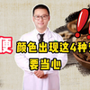 观尿液知健康，小便颜色出现这4种变化，要当心
