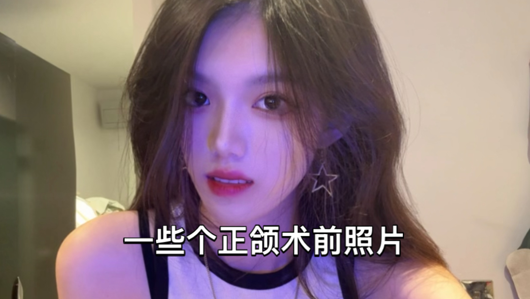 正颌失败毁容｜每次翻到术前照片还是会emo的想哭 为什么把我毁成这样…