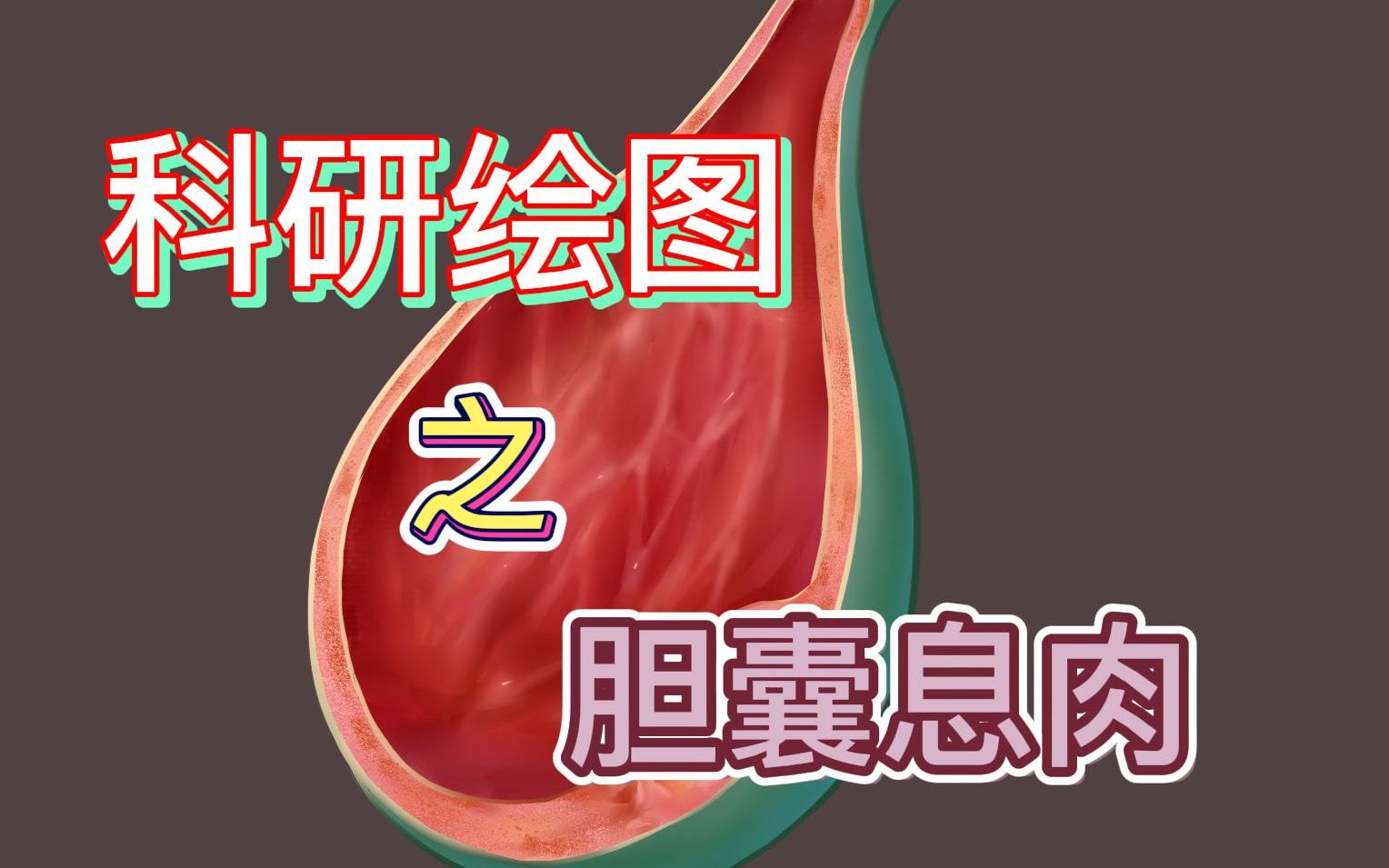 临床医学手绘 胆囊息肉