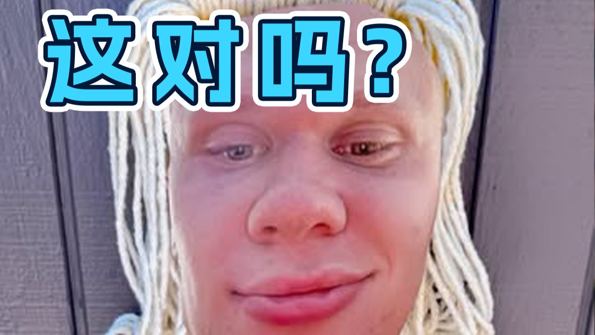 当哈兰德表情包与现实完美融合