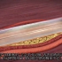 冠状动脉血管成形术（心脏支架介入手术）最直观视频讲解