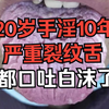 舌诊分析：20岁手淫10年，每天六七次，都口吐白沫了