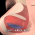 鼻子歪需要手术吗，鼻中隔偏曲手术过程，3D演示。。