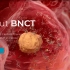 生物医学动画#科学原理动画-C02-硼中子俘获疗法BNCT