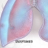 肺被捅破了的后果，开放性气胸的发生过程，3D演示。。