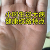 小时候生过大病的纹路特点