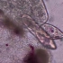 显微镜观察变形虫狩猎