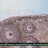 【3D医学动画】了解卵巢癌（中英双字幕+原版英文）