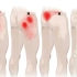臀中肌 | 稳定骨盆的核心肌肉，也是调理腰膝疼痛不能忽略的肌肉！