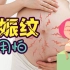【飞碟宝贝计划】第一次长在身上的妊娠纹