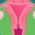 动画了解女性生殖系统