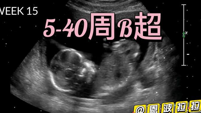 5-40周宝宝B超完整过程 怀孕妈妈必看系列 大家有猜出是男孩还是女孩吗?