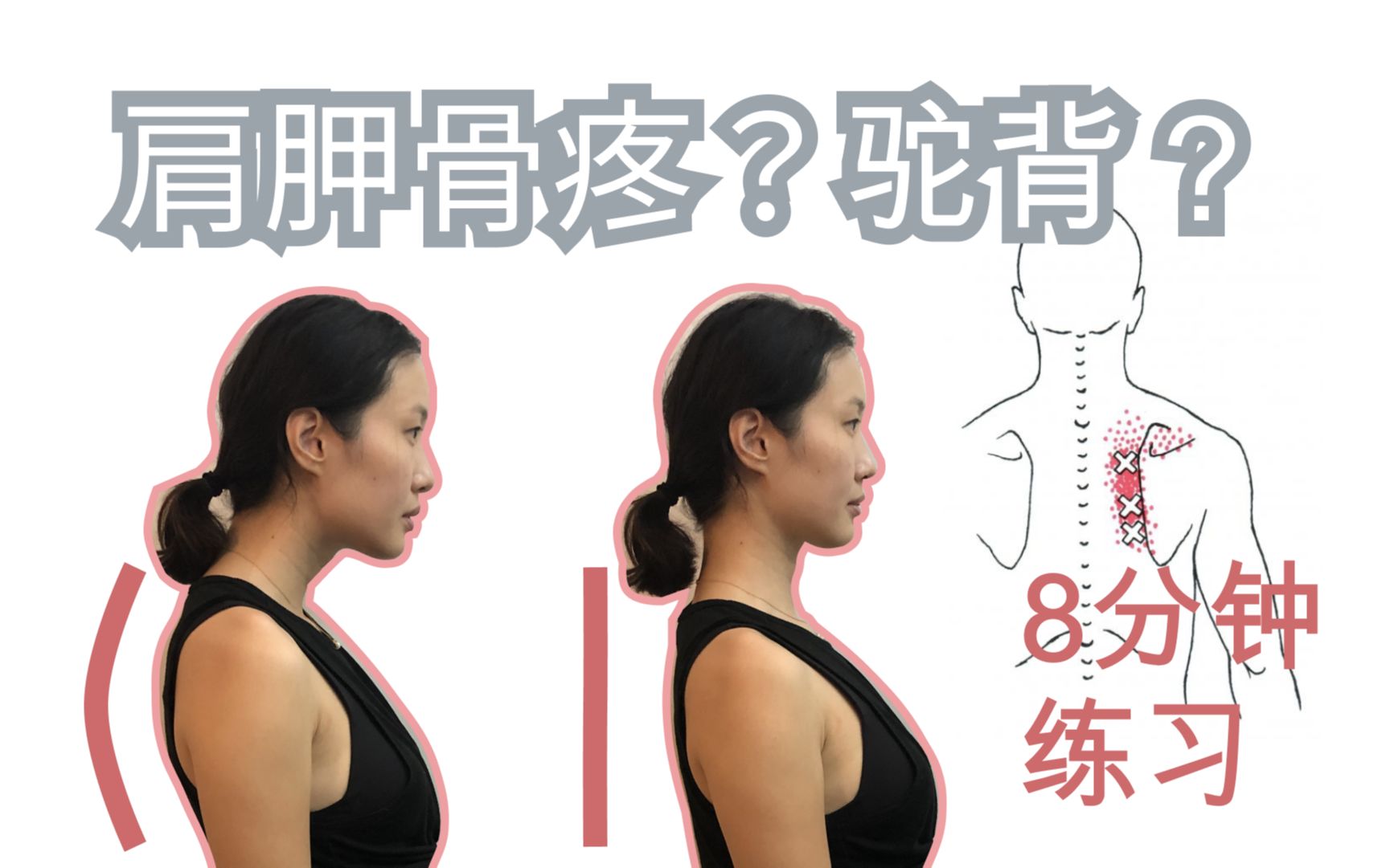 圆肩驼背1如何维持好坐姿8分钟改善肩胛骨疼痛及圆肩驼背