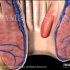 【3D医学动画】痔疮是怎么形成的？