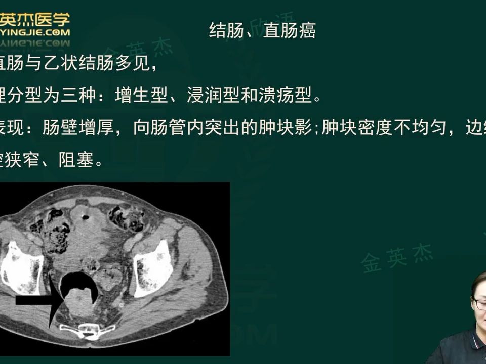 2025年放射医学技士、师、中级考试第2篇 相关专业知识-第6章（3）
