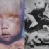 日本《731部队》，用福尔马林泡制婴儿做实验