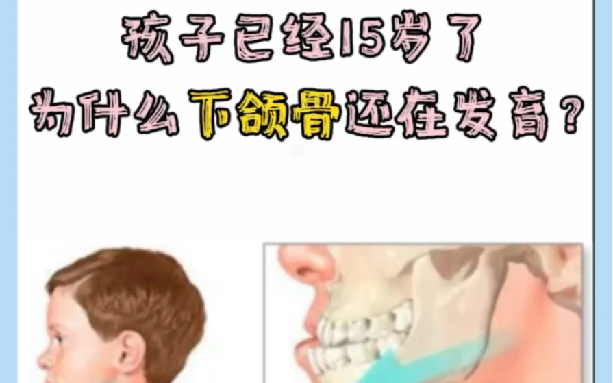 孩子15岁已经过了下颌发育高峰期为什么还在生长？