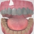四环素牙、氟斑牙应该怎么办？