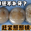 这就是补牙的最高境界，化腐朽为神奇