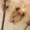 阴虱是如何引起的 #阴虱 #虱子 #科普