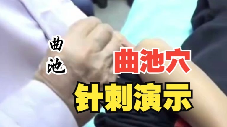 曲池穴针刺演示