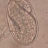【寄生虫】钩虫蚴卵-显微镜高倍观察