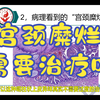 “宫颈糜烂”需要治疗吗？？？什么样的宫颈病变才需要治疗