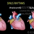 【双语熟肉】心律失常 Cardiac Arrhythmias by AlilaMedicalMedia