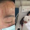 物业醉酒上门收费引冲突，业主女儿手筋断2根后续：业主取保1年对方拘15日