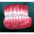 长期夜磨牙会导致牙齿损耗，而且不容易修复！磨牙垫了解一下吧「大连齿医生口腔修复中心」「大连口腔医院」
