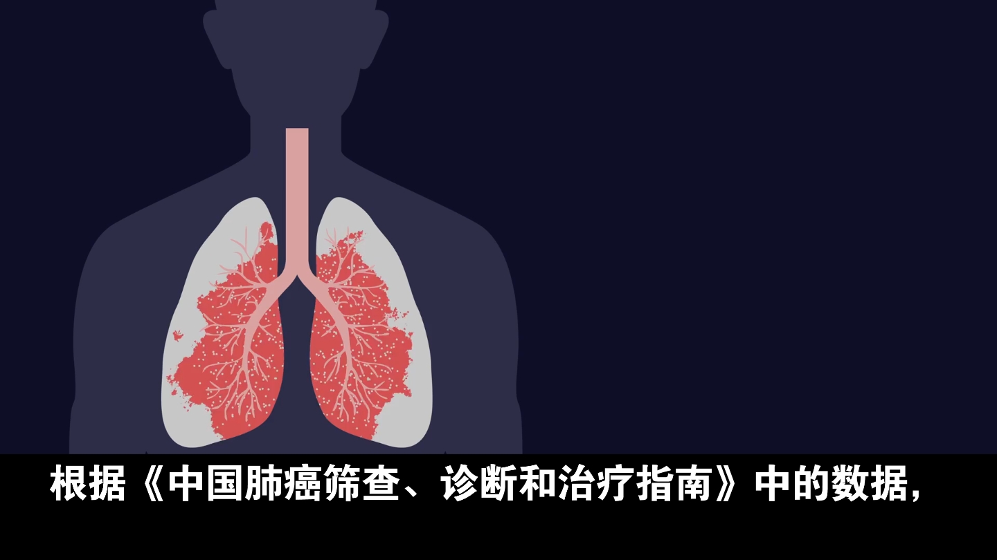 为啥肺癌一发现即晚期？提醒：若有“1粗1麻2痛”，建议早做筛查