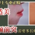 北京牙齿矫正杨磊正畸案例：双颌前突+嘴突明显，隐适美矫正需要多久时间？
