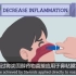 【中英双语字幕】什么是过敏性鼻炎 What is Allergic Rhinitis