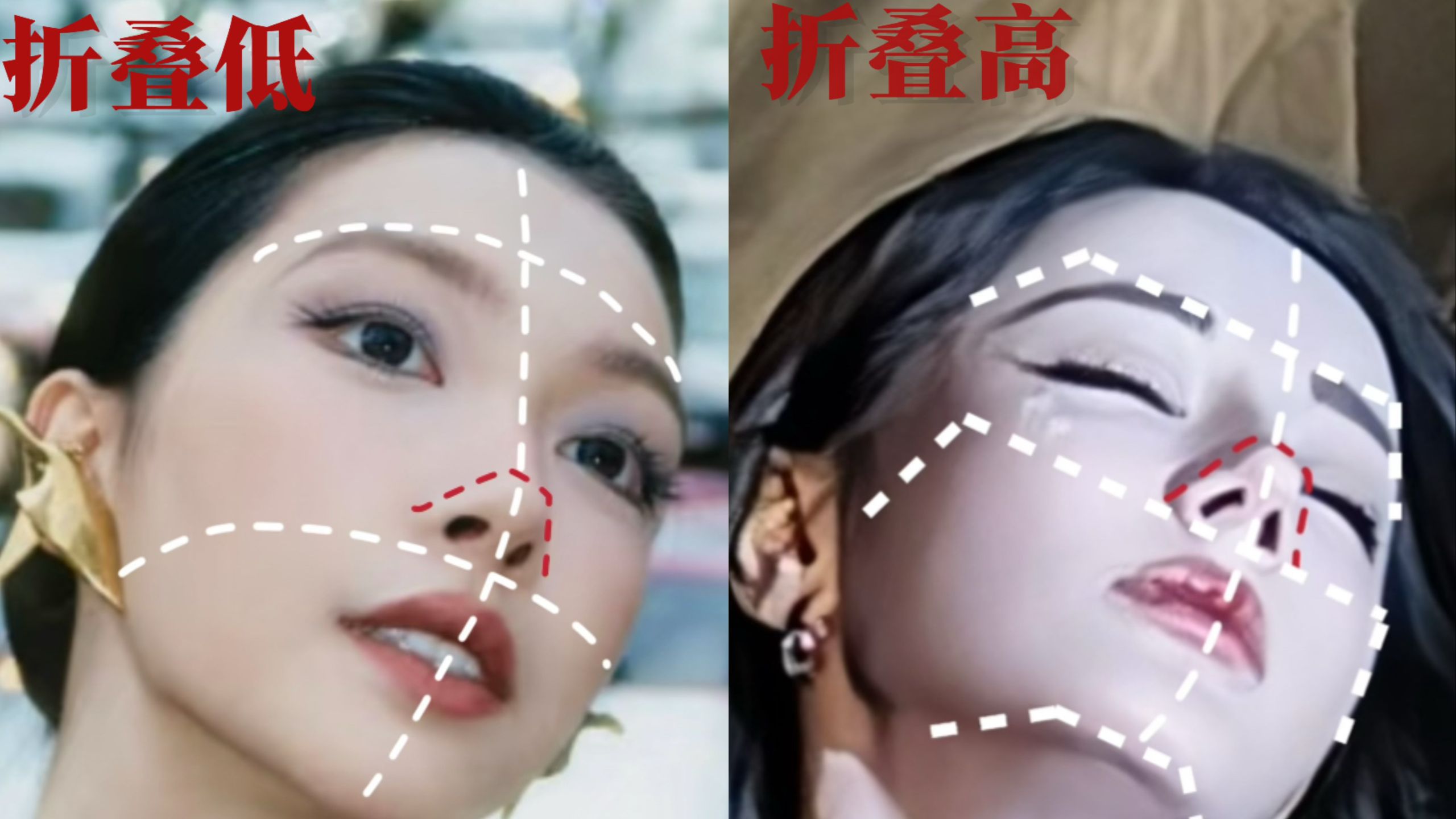 破防了…原来拉高鼻子并不会提高面部折叠度