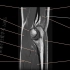 6.关节MRI解剖图谱-肘关节MRI解剖