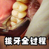 拔牙全过程！超级治愈