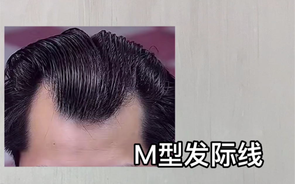 M型发际线、高额头、头发贴的可以这样造型