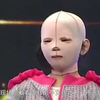 小女孩全身烧伤经历多次手术，脱下面具的那一刻，傻眼了