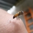 一只蜜蜂蜇了你之后…