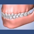 【科普】牙齿缺失不及时治疗会有什么危害呢？深圳牙科