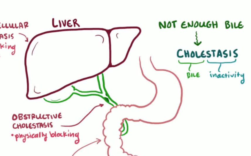 【搬运osmosis】liver cholestasis