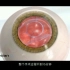 徐州近视手术——ICL晶体植入手术全过程3D动画演示