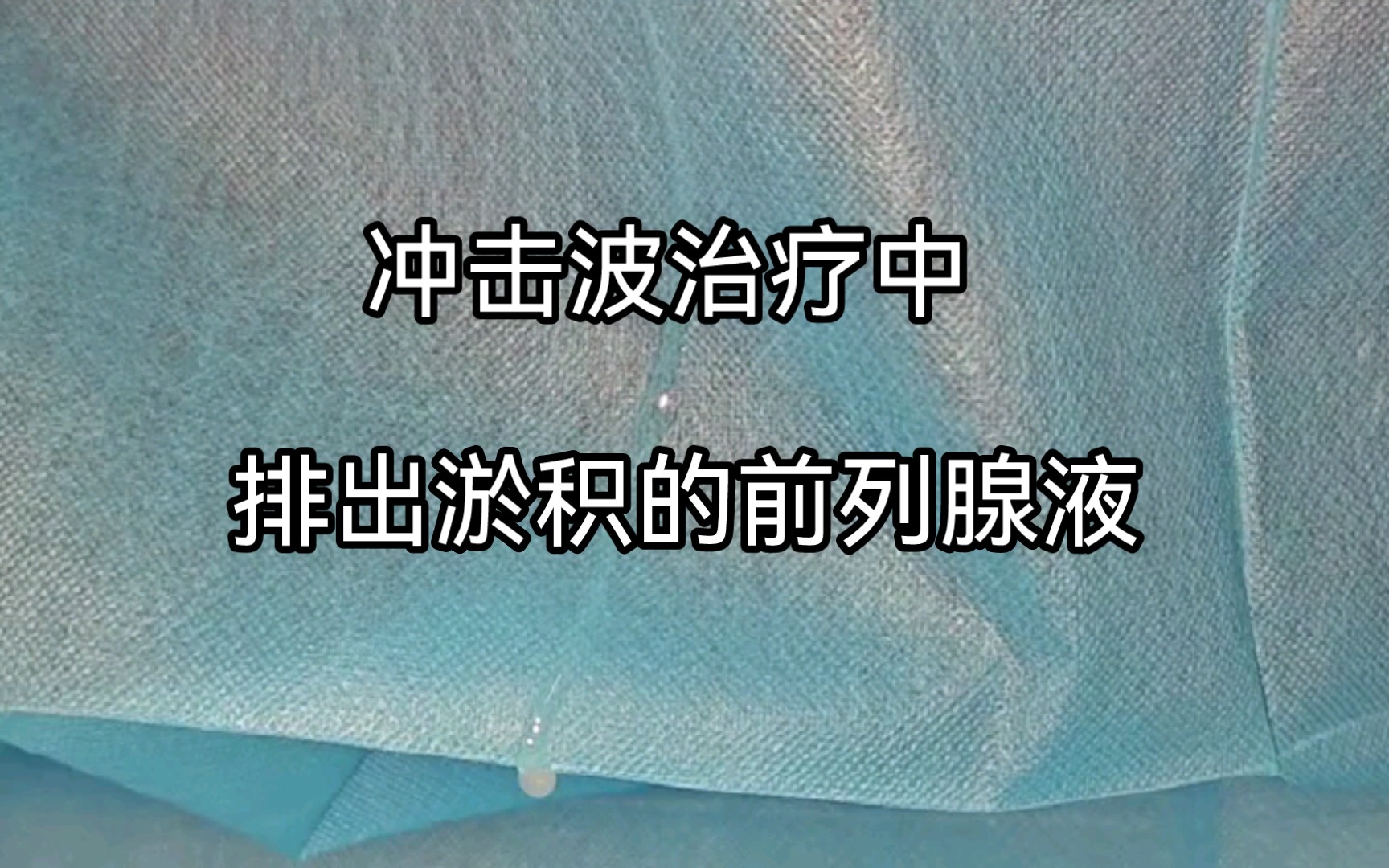 冲击波后排出淤积的前列腺液