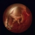 攝影師花12年拍下「寶寶在子宮發育過程」震撼人心，第16週「血管清晰可見」秒懂生命奧妙！